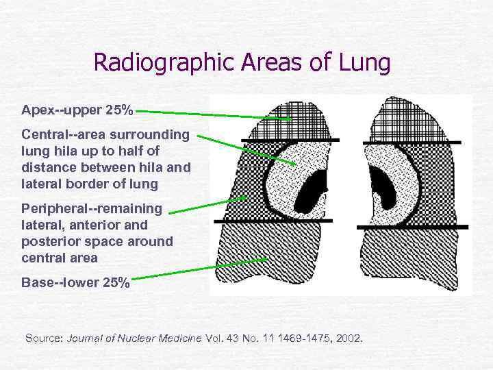 Radiographic Areas of Lung Apex--upper 25% Central--area surrounding lung hila up to half of