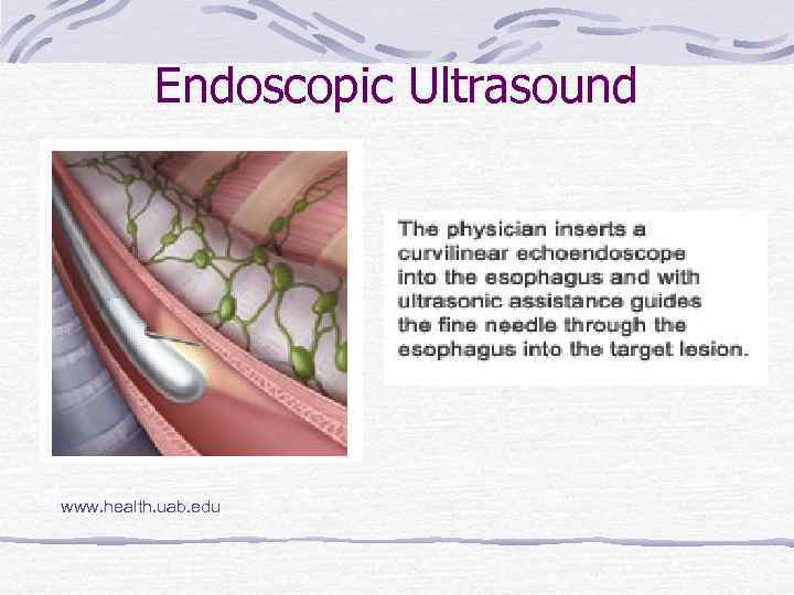 Endoscopic Ultrasound www. health. uab. edu 