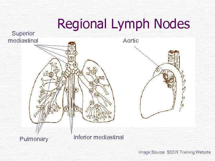 Superior mediastinal Pulmonary Regional Lymph Nodes Aortic Inferior mediastinal Image Source: SEER Training Website