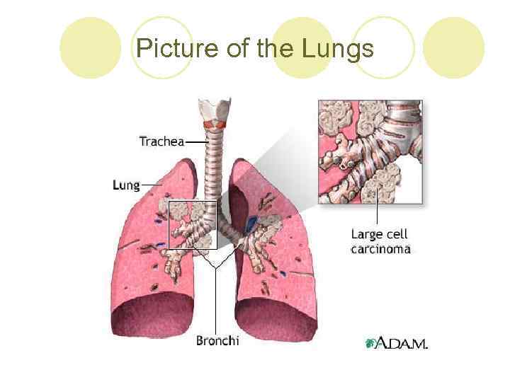 Picture of the Lungs 