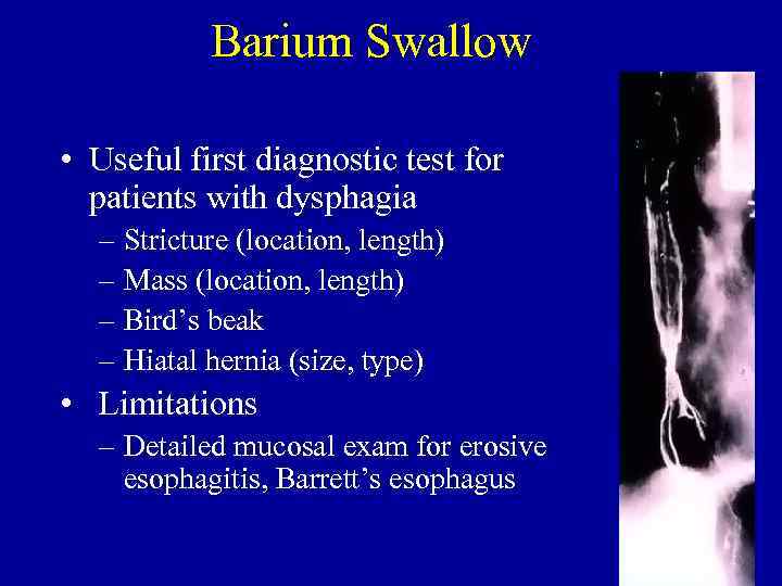 Barium Swallow • Useful first diagnostic test for patients with dysphagia – Stricture (location,