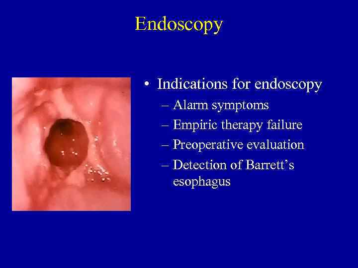 Endoscopy • Indications for endoscopy – Alarm symptoms – Empiric therapy failure – Preoperative