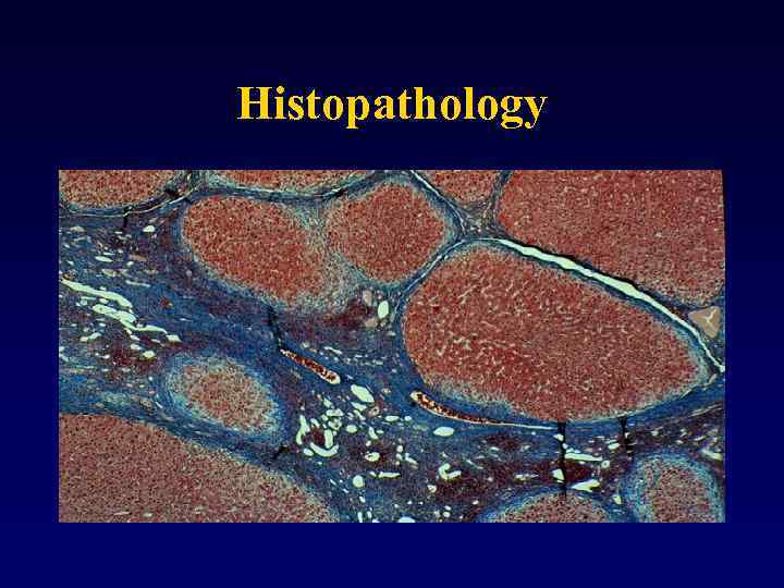 Histopathology 