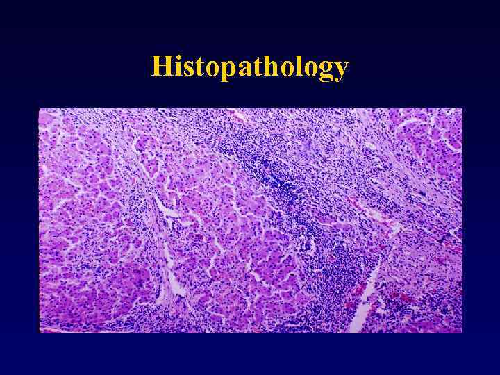 Histopathology 