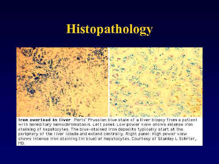 Histopathology 