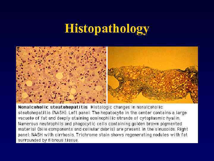 Histopathology 