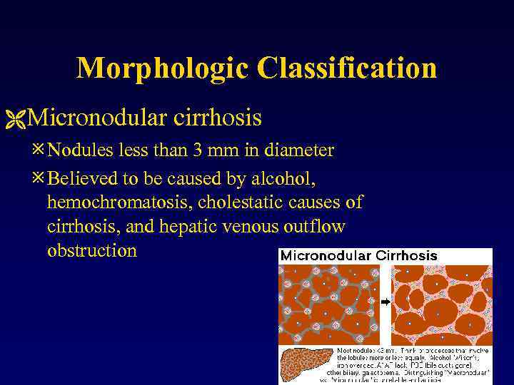 Morphologic Classification ËMicronodular cirrhosis ø Nodules less than 3 mm in diameter ø Believed