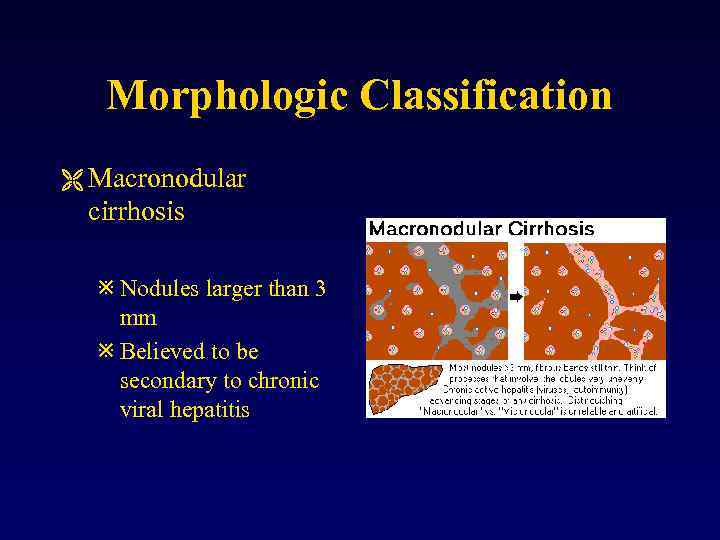 Morphologic Classification Ë Macronodular cirrhosis ø Nodules larger than 3 mm ø Believed to