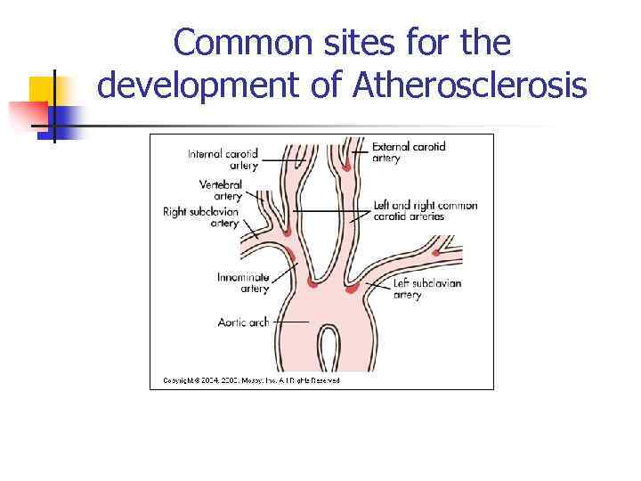 Common sites for the development of Atherosclerosis 