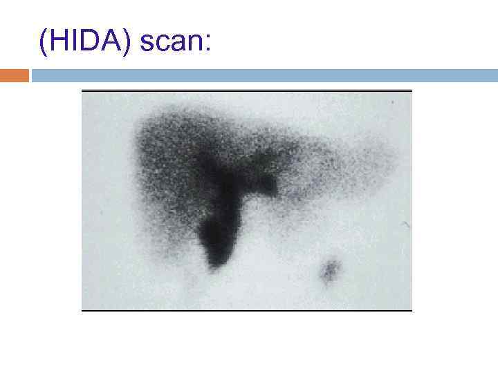 (HIDA) scan: 
