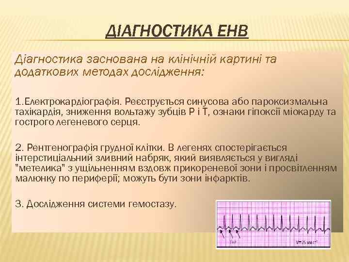 ДІАГНОСТИКА ЕНВ Діагностика заснована на клінічній картині та додаткових методах дослідження: 1. Електрокардіографія. Реєструється