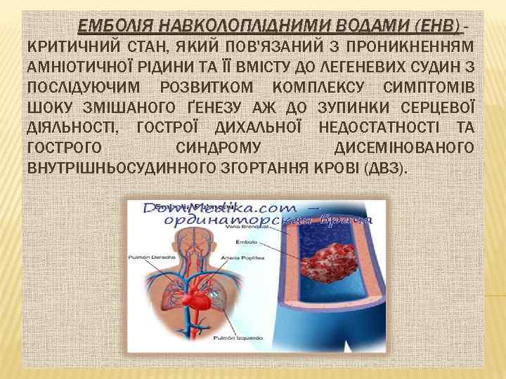 ЕМБОЛІЯ НАВКОЛОПЛІДНИМИ ВОДАМИ (ЕНВ) КРИТИЧНИЙ СТАН, ЯКИЙ ПОВ'ЯЗАНИЙ З ПРОНИКНЕННЯМ АМНІОТИЧНОЇ РІДИНИ ТА ЇЇ