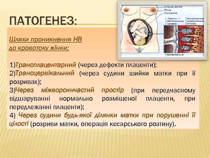 ПАТОГЕНЕЗ: Шляхи проникнення НВ до кровотоку жінки: 1)Трансплацентарний (через дефекти плаценти); 2)Трансцервікальний (через судини