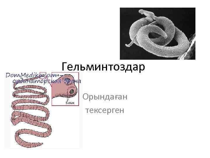 Гельминтоздар Орындаған тексерген 