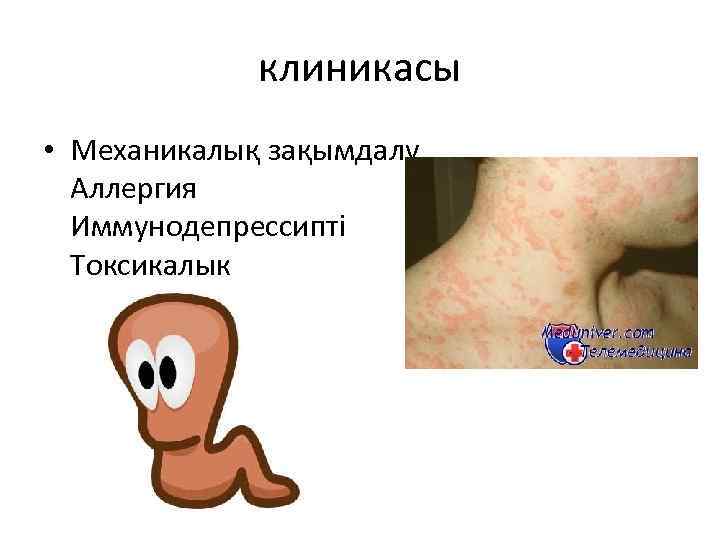 клиникасы • Механикалық зақымдалу Аллергия Иммунодепрессипті Токсикалык 