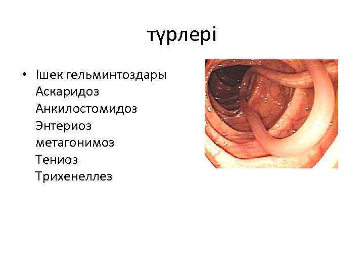 түрлері • Ішек гельминтоздары Аскаридоз Анкилостомидоз Энтериоз метагонимоз Тениоз Трихенеллез 