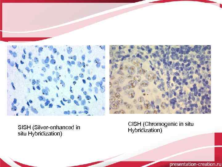 SISH (Silver-enhanced in situ Hybridization) CISH (Chromogenic in situ Hybridization) 