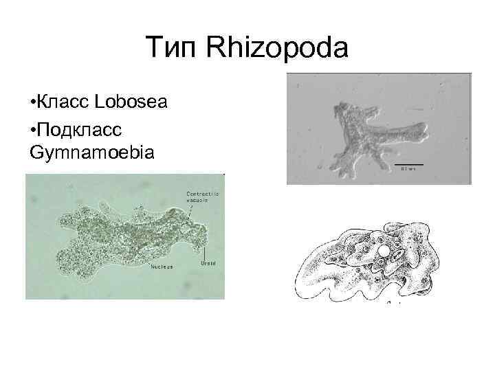 Тип Rhizopoda • Класс Lobosea • Подкласс Gymnamoebia 
