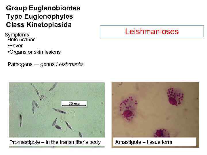 Group Euglenobiontes Type Euglenophyles Class Kinetoplasida Symptoms • Intoxication • Fever • Organs or