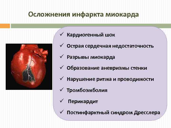 Осложнения инфаркта миокарда ü Кардиогенный шок ü Острая сердечная недостаточность ü Разрывы миокарда ü