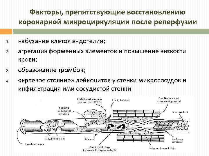 Факторы, препятствующие восстановлению коронарной микроциркуляции после реперфузии 1) 2) 3) 4) набухание клеток эндотелия;