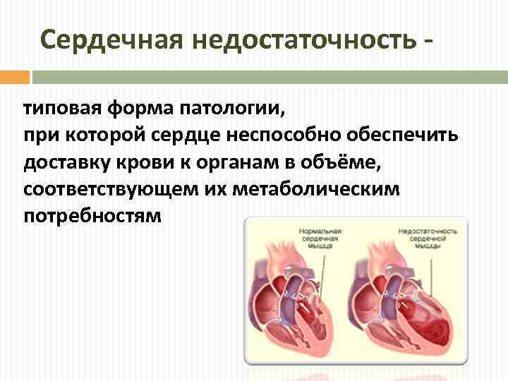 Разрывы сердца понятие патогенез клиническая картина диагностика и принципы лечения