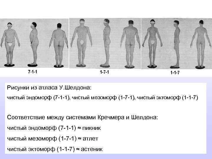 Рисунки из атласа У. Шелдона: чистый эндоморф (7 -1 -1), чистый мезоморф (1 -7