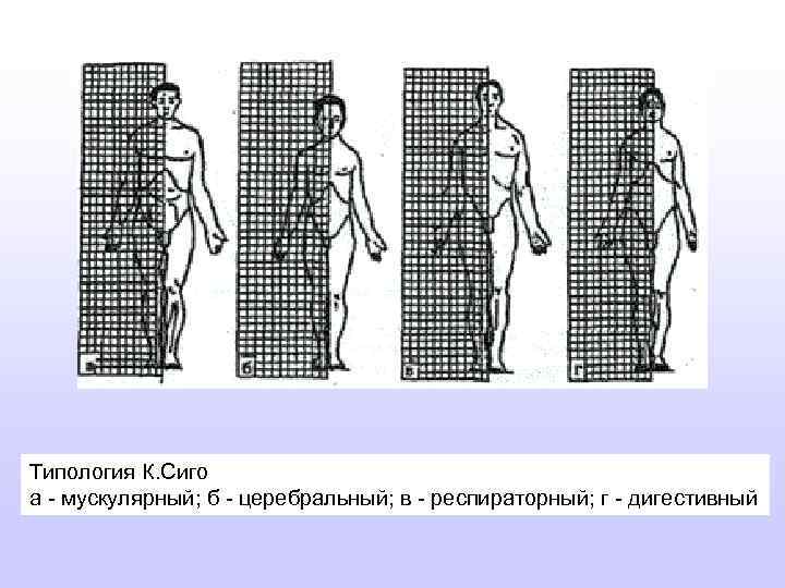 Типология К. Сиго а - мускулярный; б - церебральный; в - респираторный; г -