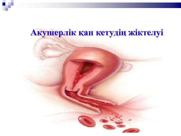 Акушерлік қан кетудің жіктелуі 