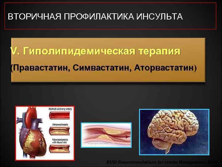 ВТОРИЧНАЯ ПРОФИЛАКТИКА ИНСУЛЬТА V. Гиполипидемическая терапия (Правастатин, Симвастатин, Аторвастатин) Аторвастатин EUSI Recommendations for stroke