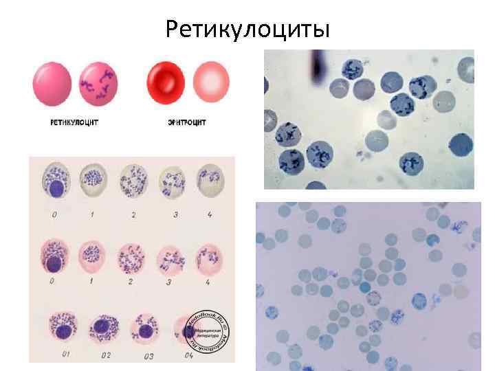 В схеме кроветворения ретикулоциты относятся к тест ответ