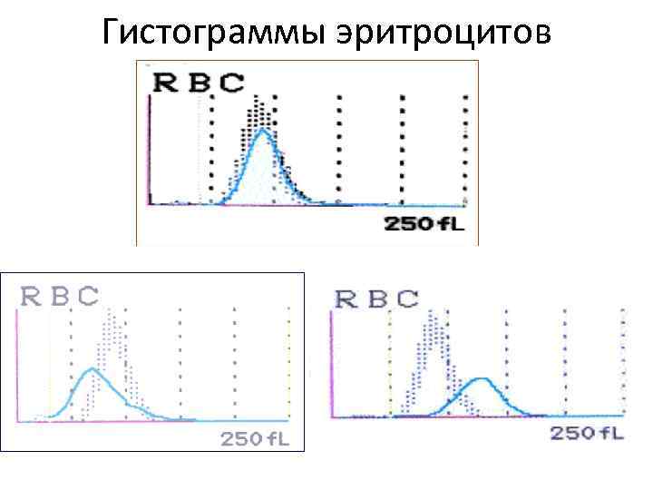 Гистограммы эритроцитов 