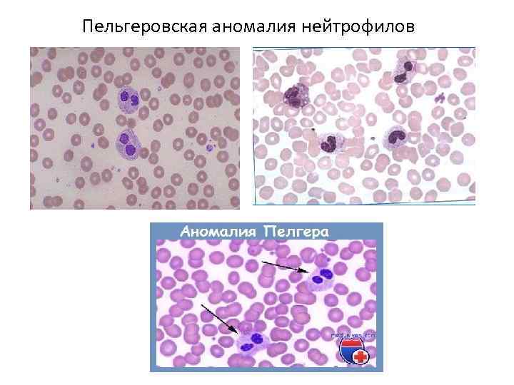 Схема созревания нейтрофилов