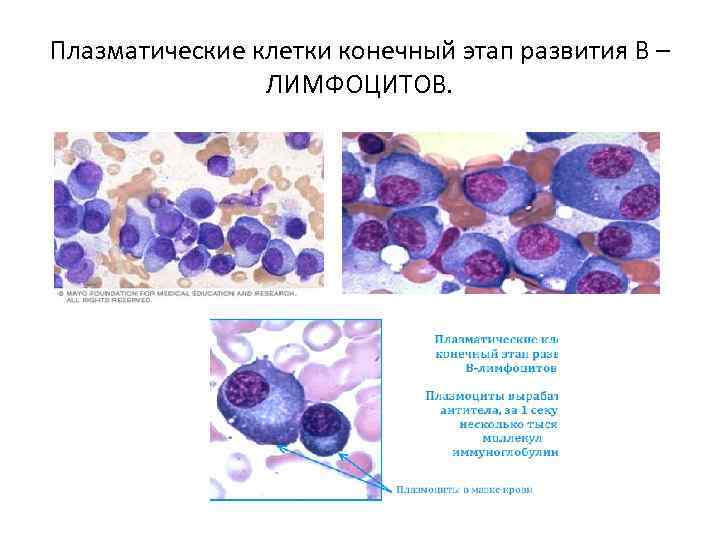 Конечные клетки. В лимфоциты превращаются в плазматические клетки. Предшественник плазматической клетки:. Плазматические клетки норма у детей 2 лет. Плазматические клетки в крови у ребенка 1.