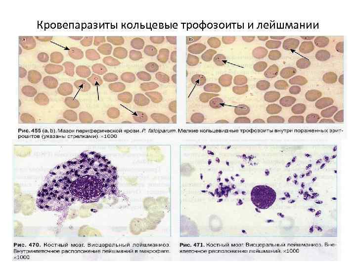 Образцы кала для выявления трофозоитов простейших следует исследовать