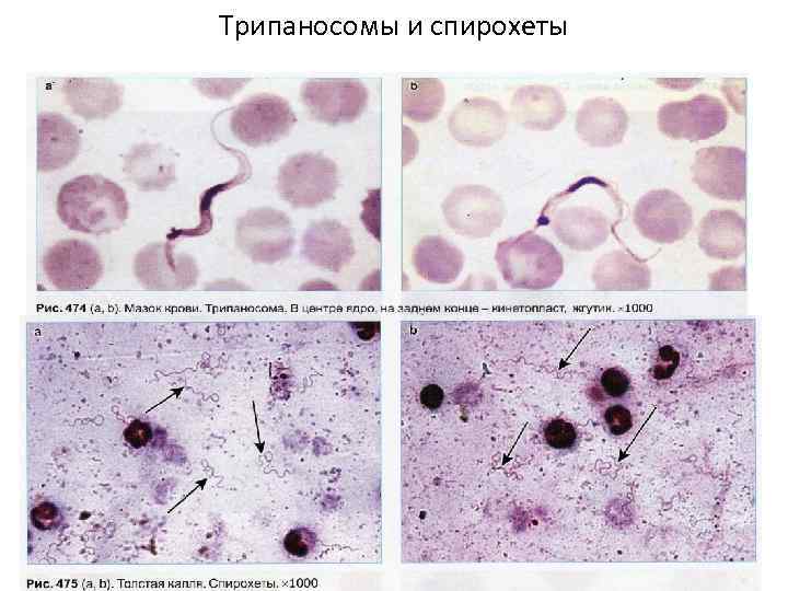 Трипаносомы и спирохеты 