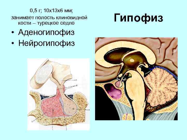 Супраселлярная цистерна пролабирует в полость