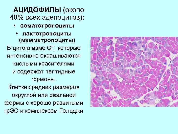 АЦИДОФИЛЫ (около 40% всех аденоцитов): • соматотропоциты • лактотропоциты (мамматропоциты) В цитоплазме СГ, которые