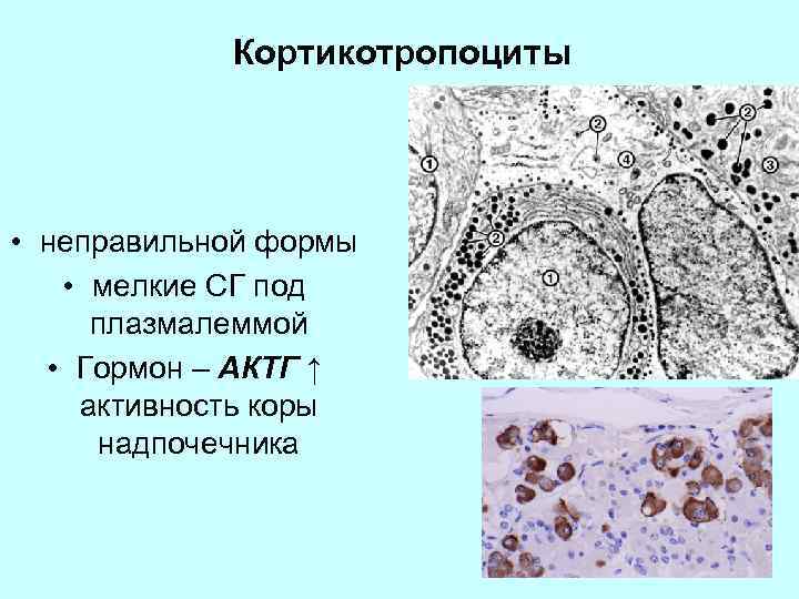 Кортикотропоциты • неправильной формы • мелкие СГ под плазмалеммой • Гормон – АКТГ ↑