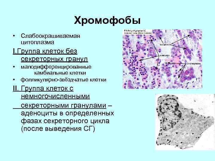 Хромофобы • Слабоокрашиваемая цитоплазма I. Группа клеток без секреторных гранул • • малодифференцированные камбиальные
