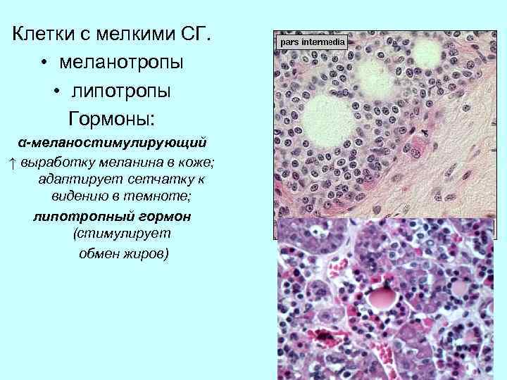 Клетки с мелкими СГ. • меланотропы • липотропы Гормоны: α-меланостимулирующий ↑ выработку меланина в