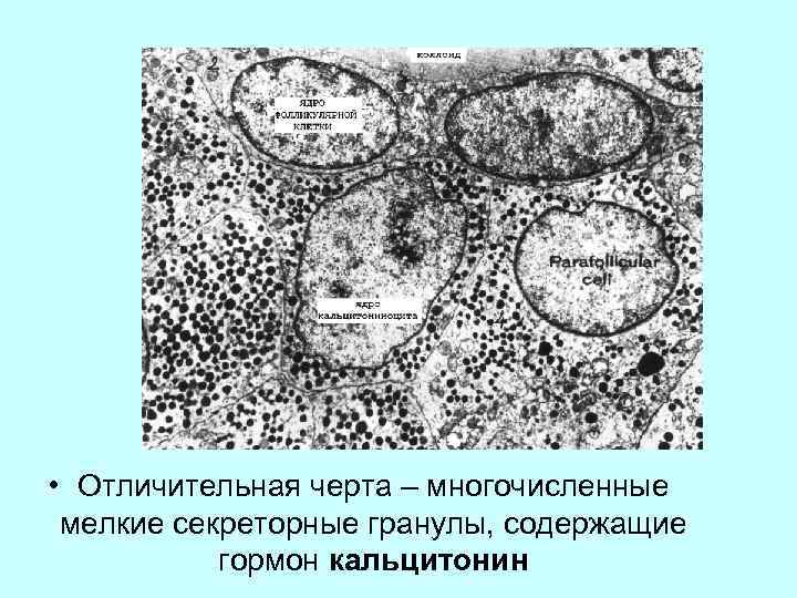  • Отличительная черта – многочисленные мелкие секреторные гранулы, содержащие гормон кальцитонин 