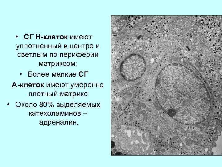  • СГ Н-клеток имеют уплотненный в центре и светлым по периферии матриксом; •