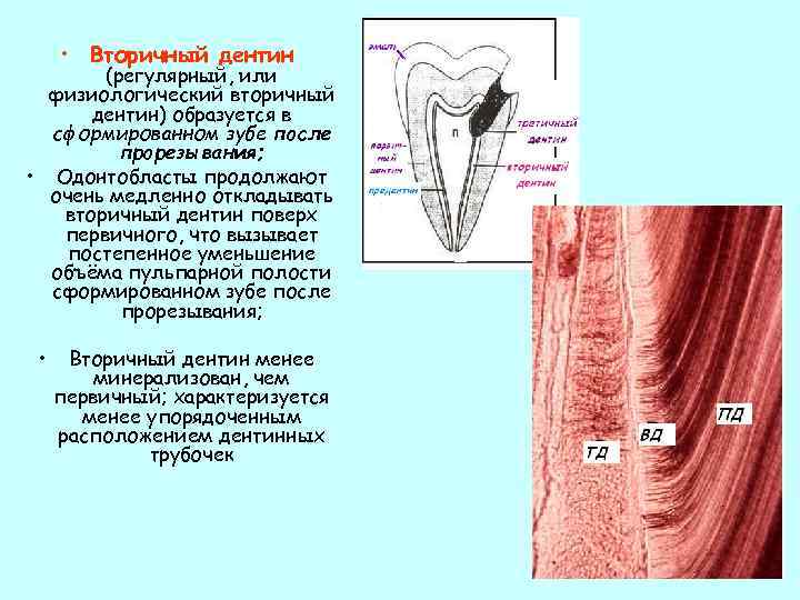 Плащевой дентин