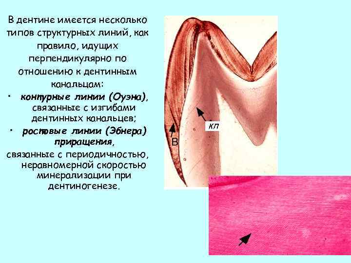 В дентине имеется несколько типов структурных линий, как правило, идущих перпендикулярно по отношению к