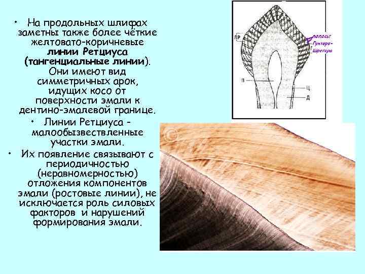  • На продольных шлифах заметны также более чёткие желтовато-коричневые линии Ретциуса (тангенциальные линии).