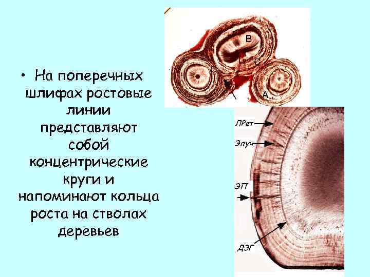  • На поперечных шлифах ростовые линии представляют собой концентрические круги и напоминают кольца