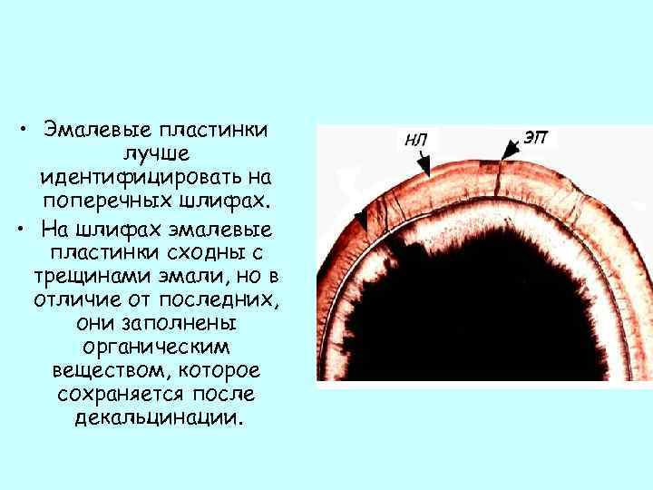  • Эмалевые пластинки лучше идентифицировать на поперечных шлифах. • На шлифах эмалевые пластинки