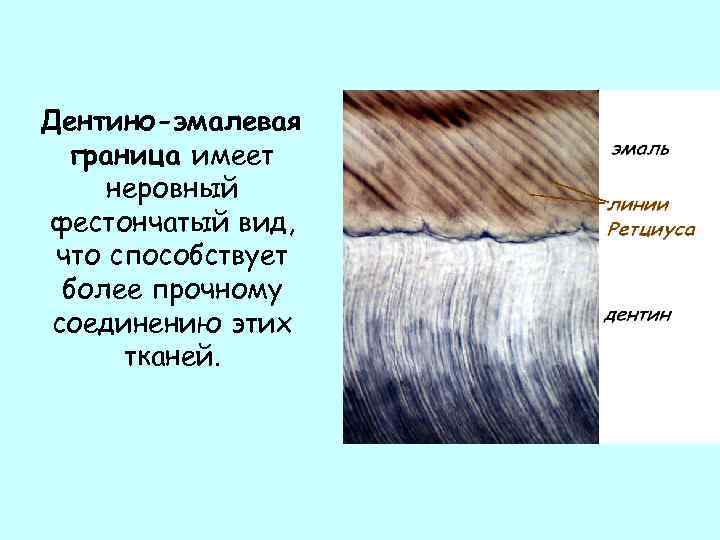 Дентино-эмалевая граница имеет неровный фестончатый вид, что способствует более прочному соединению этих тканей. 