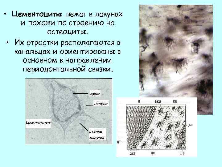  • Цементоциты лежат в лакунах и похожи по строению на остеоциты. • Их